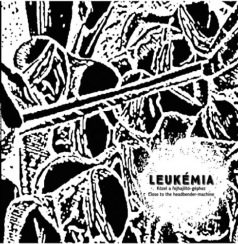 Leukémia: Közel a fejhajlító-géphez WHITE LP